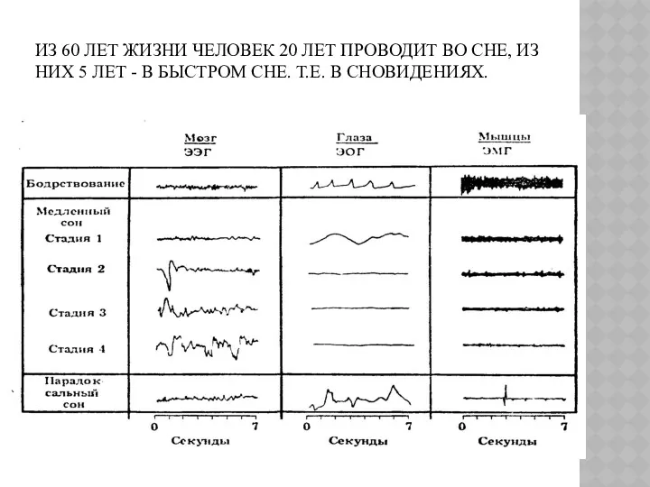 ИЗ 60 ЛЕТ ЖИЗНИ ЧЕЛОВЕК 20 ЛЕТ ПРОВОДИТ ВО СНЕ, ИЗ НИХ 5