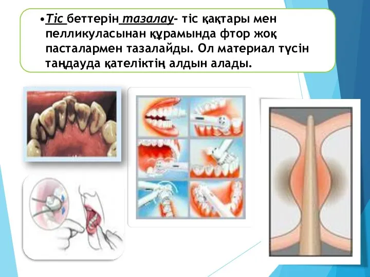 Тіс беттерін тазалау- тіс қақтары мен пелликуласынан құрамында фтор жоқ