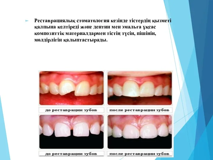 Реставрациялық стоматология кезінде тістердің қызметі қалпына келтіреді және дентин мен