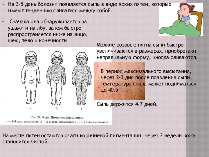 На 3-5 день болезни появляется сыпь в виде ярких пятен,