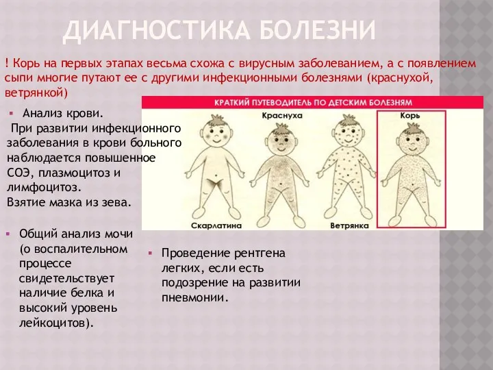 ДИАГНОСТИКА БОЛЕЗНИ ! Корь на первых этапах весьма схожа с