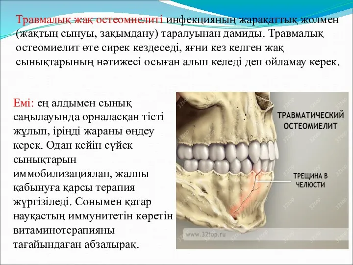 Емі: ең алдымен сынық саңылауында орналасқан тісті жұлып, іріңді жараны