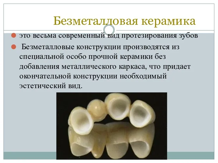 Безметалловая керамика это весьма современный вид протезирования зубов Безметалловые конструкции производятся из специальной
