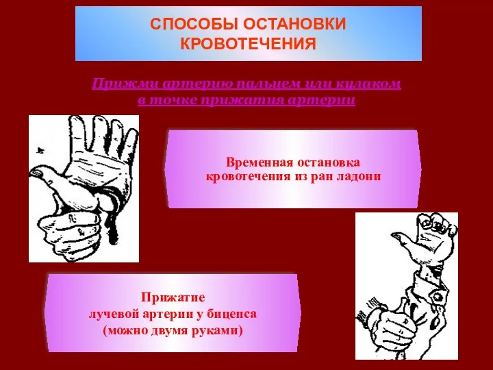 СПОСОБЫ ОСТАНОВКИ КРОВОТЕЧЕНИЯ Прижми артерию пальцем или кулаком в точке