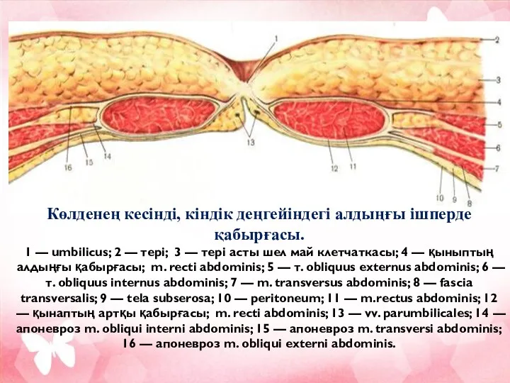 Көлденең кесінді, кіндік деңгейіндегі алдыңғы ішперде қабырғасы. 1 — umbilicus;