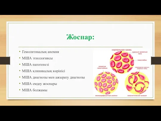 Жоспар: Гемолитикалық анемия МША этиологиясы МША патогенезі МША клиникалық көрінісі