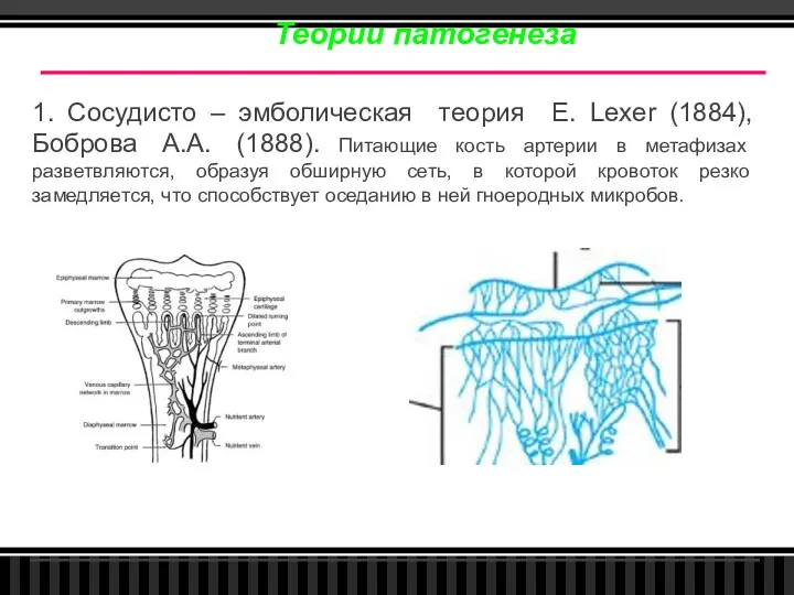 Теории патогенеза 1. Сосудисто – эмболическая теория E. Lexer (1884),