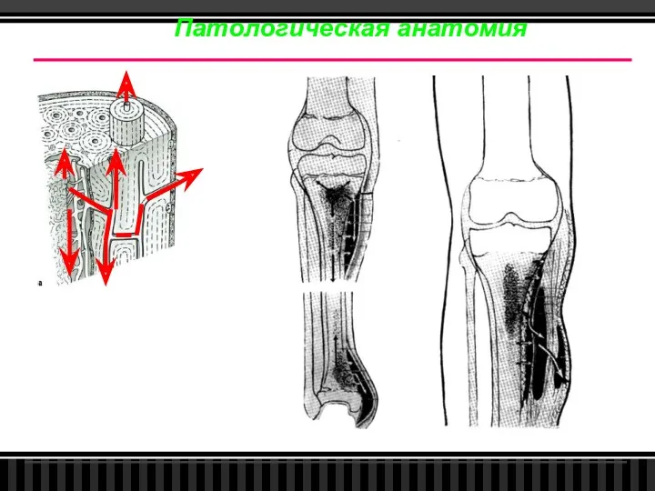 Патологическая анатомия