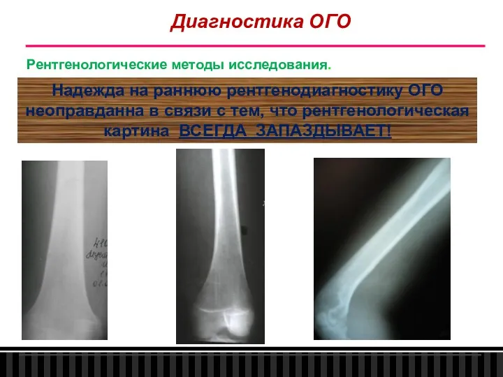 Диагностика ОГО Рентгенологические методы исследования. Надежда на раннюю рентгенодиагностику ОГО