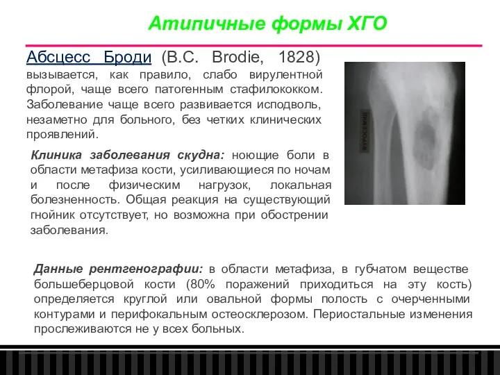 Абсцесс Броди (В.С. Brodie, 1828) вызывается, как правило, слабо вирулентной