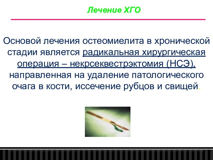 Лечение ХГО Основой лечения остеомиелита в хронической стадии является радикальная