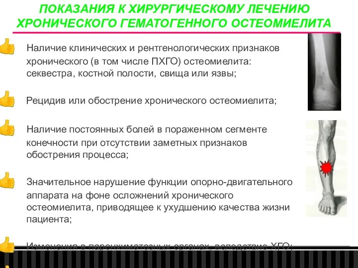 ПОКАЗАНИЯ К ХИРУРГИЧЕСКОМУ ЛЕЧЕНИЮ ХРОНИЧЕСКОГО ГЕМАТОГЕННОГО ОСТЕОМИЕЛИТА Наличие клинических и рентгенологических признаков хронического