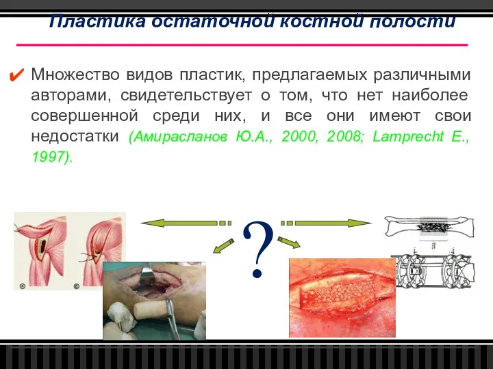 Множество видов пластик, предлагаемых различными авторами, свидетельствует о том, что нет наиболее совершенной