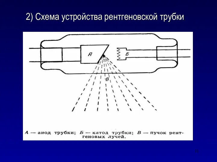 2) Схема устройства рентгеновской трубки