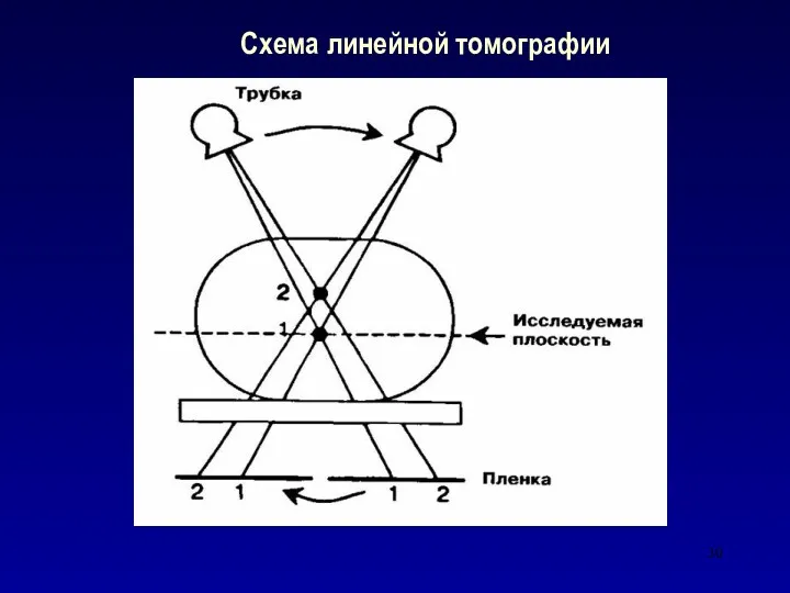 Схема линейной томографии