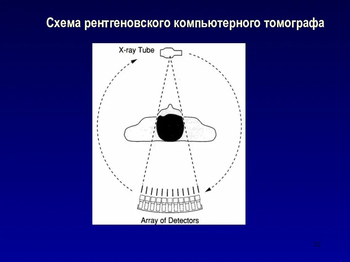 Схема рентгеновского компьютерного томографа