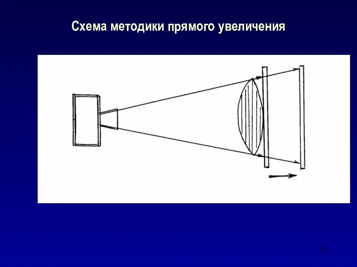 Схема методики прямого увеличения