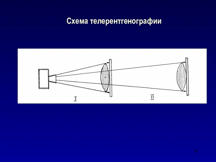 Схема телерентгенографии