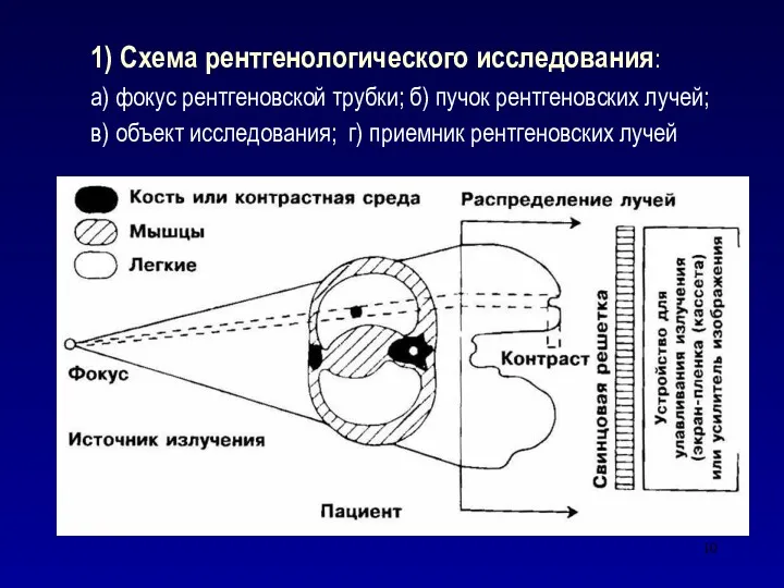 1) Схема рентгенологического исследования: а) фокус рентгеновской трубки; б) пучок