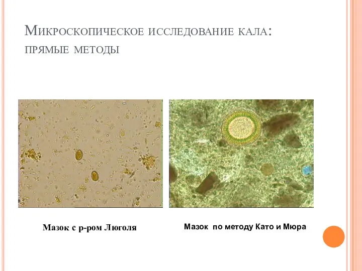 Микроскопическое исследование кала: прямые методы Мазок по методу Като и Мюра Мазок с р-ром Люголя