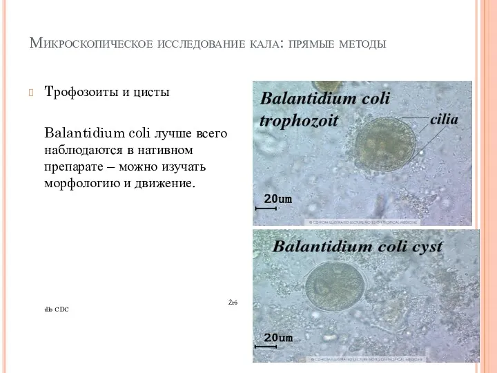 Микроскопическое исследование кала: прямые методы Tрофозоиты и цисты Balantidium coli