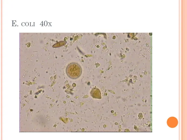 E. coli 40x