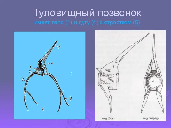 Туловищный позвонок имеет тело (1) и дугу (4) с отростком (5)