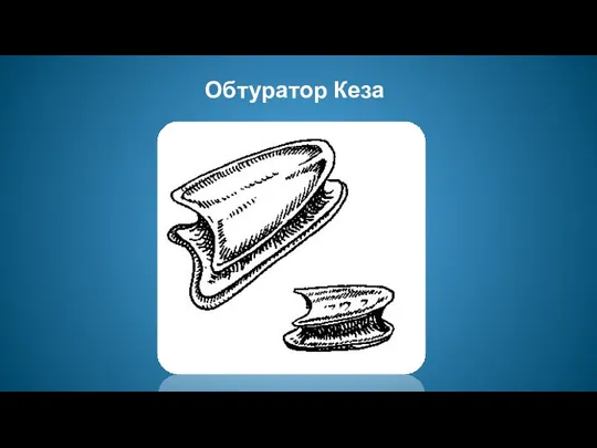 Обтуратор Кеза