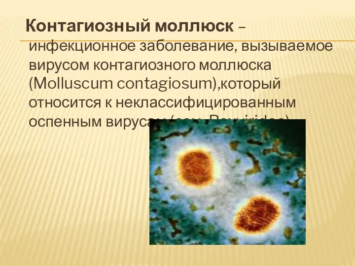 Контагиозный моллюск – инфекционное заболевание, вызываемое вирусом контагиозного моллюска(Molluscum contagiosum),который