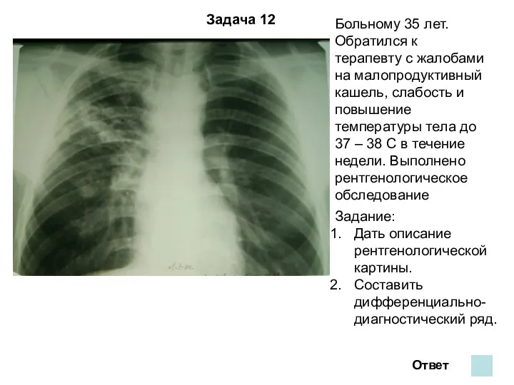 Задача 12 Больному 35 лет. Обратился к терапевту с жалобами