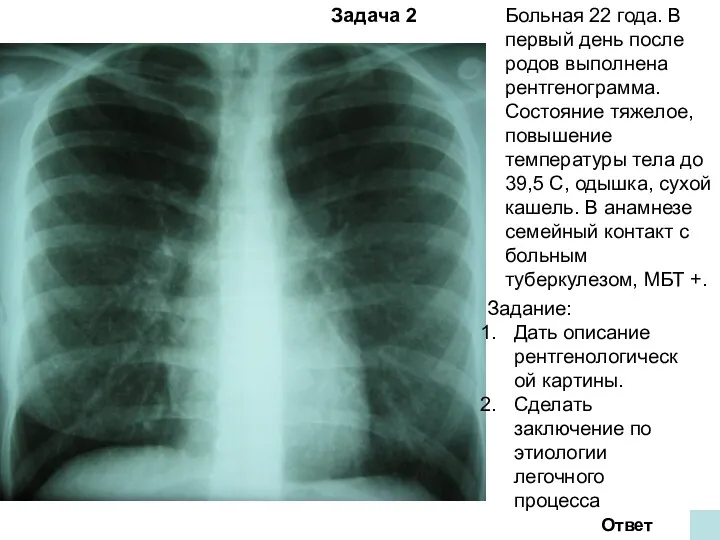 Задача 2 Ответ Больная 22 года. В первый день после