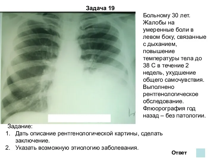 Задача 19 Ответ Больному 30 лет. Жалобы на умеренные боли