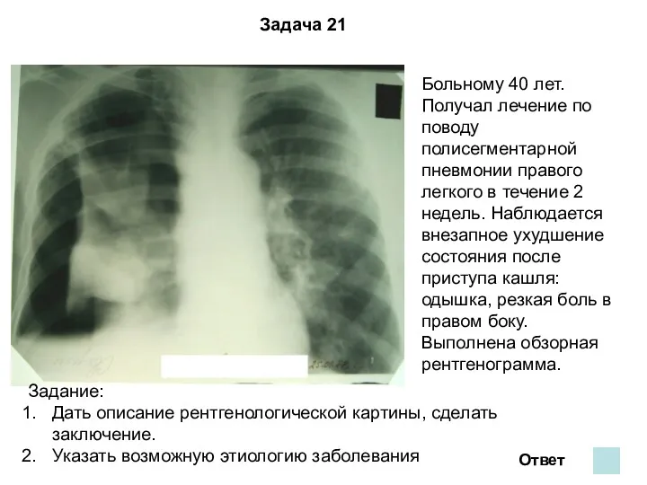 Задача 21 Ответ Больному 40 лет. Получал лечение по поводу