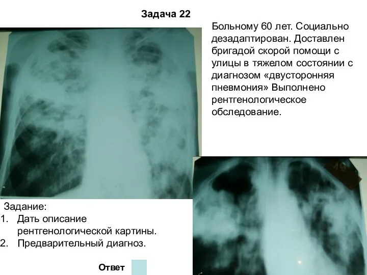 Задача 22 Ответ Больному 60 лет. Социально дезадаптирован. Доставлен бригадой