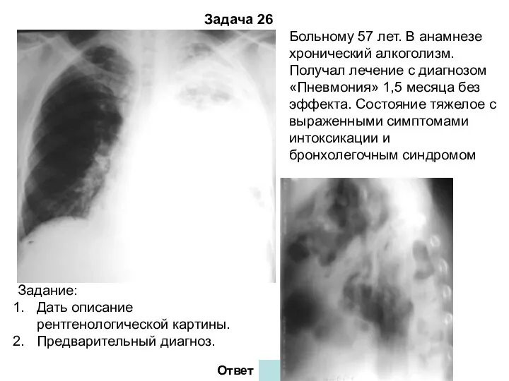 Задача 26 Ответ Больному 57 лет. В анамнезе хронический алкоголизм.