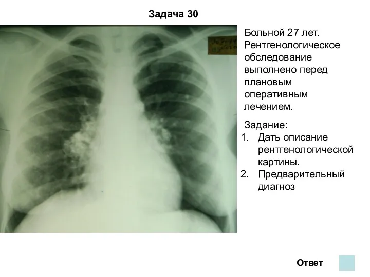 Задача 30 Ответ Больной 27 лет. Рентгенологическое обследование выполнено перед