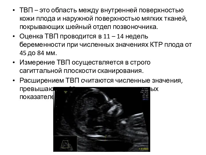 ТВП – это область между внутренней поверхностью кожи плода и