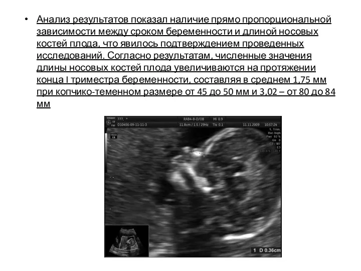 Анализ результатов показал наличие прямо пропорциональной зависимости между сроком беременности