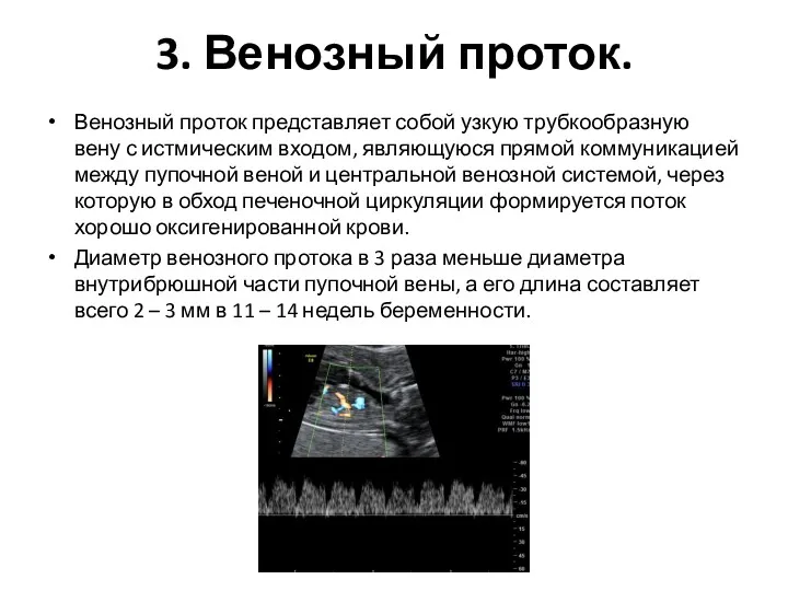 3. Венозный проток. Венозный проток представляет собой узкую трубкообразную вену