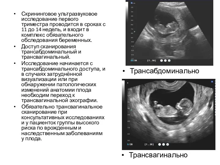 Скрининговое ультразвуковое исследование первого триместра проводится в сроках с 11