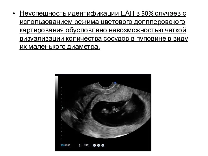 Неуспешность идентификации ЕАП в 50% случаев с использованием режима цветового