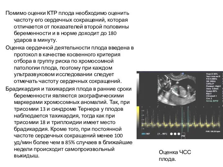 Помимо оценки КТР плода необходимо оценить частоту его сердечных сокращений,