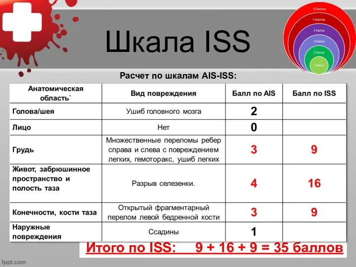 Шкала ISS Итого по ISS: 9 + 16 + 9