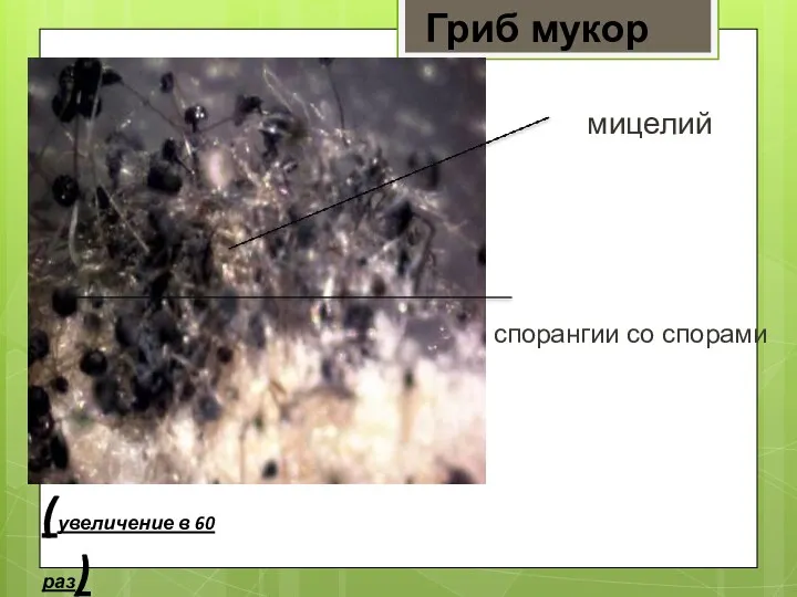 Гриб мукор (увеличение в 60 раз) спорангии со спорами мицелий