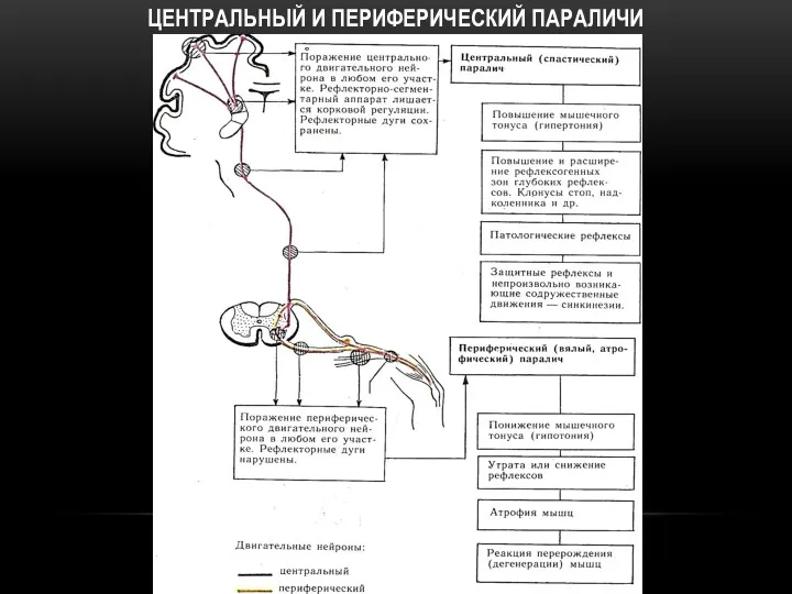 ЦЕНТРАЛЬНЫЙ И ПЕРИФЕРИЧЕСКИЙ ПАРАЛИЧИ