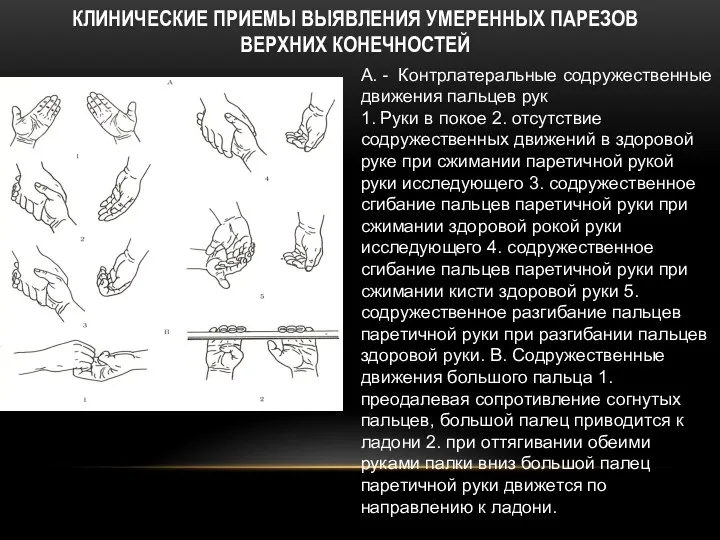 КЛИНИЧЕСКИЕ ПРИЕМЫ ВЫЯВЛЕНИЯ УМЕРЕННЫХ ПАРЕЗОВ ВЕРХНИХ КОНЕЧНОСТЕЙ А. - Контрлатеральные