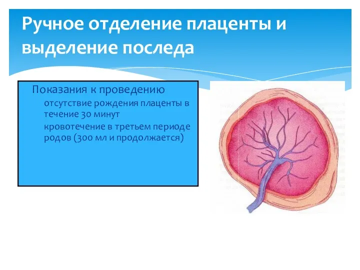 Ручное отделение плаценты и выделение последа Показания к проведению отсутствие