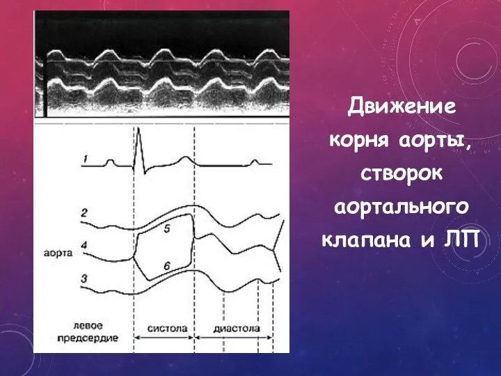 Движение корня аорты, створок аортального клапана и ЛП