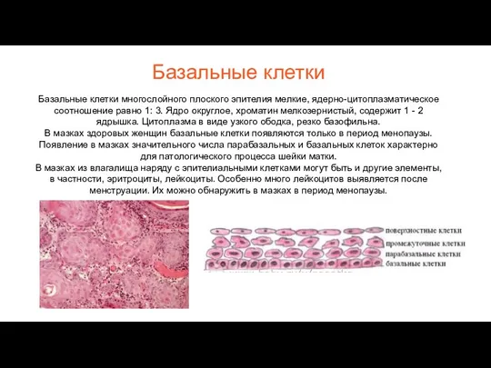 Базальные клетки Базальные клетки многослойного плоского эпителия мелкие, ядерно-цитоплазматическое соотношение