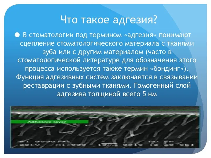 Что такое адгезия? В стоматологии под термином «адгезия» понимают сцепление